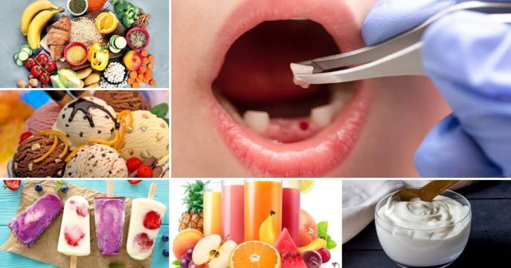 foods to give your child after a tooth extraction