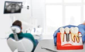 How to prevent cavities in kids in Walnut Creek